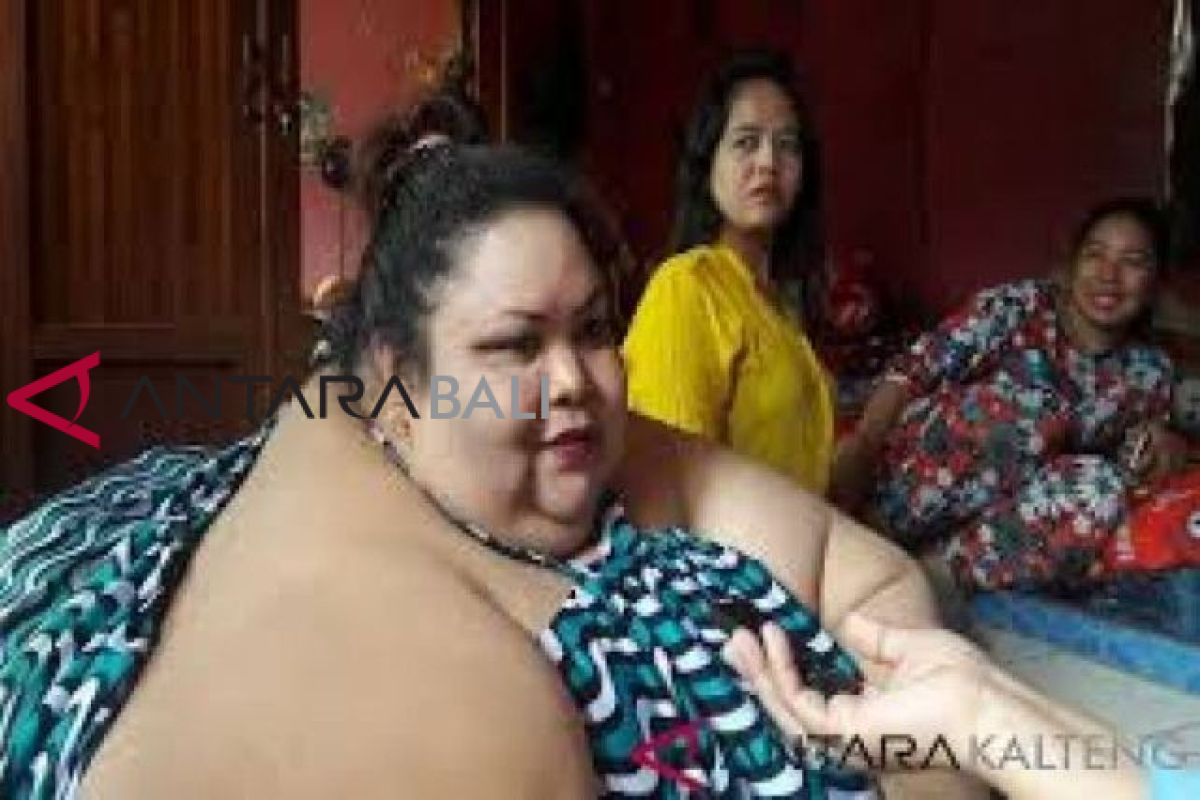 16 dokter tangani operasi perempuan berbobot 350 Kg