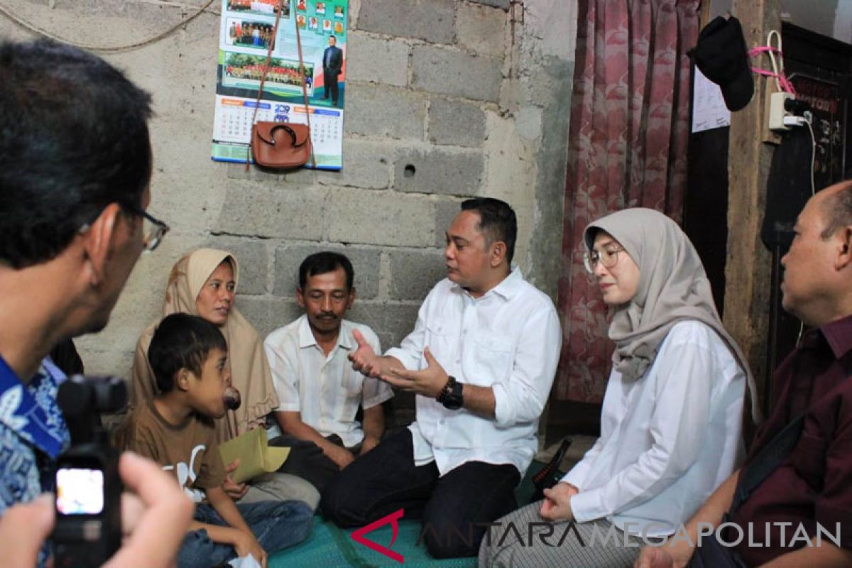 Plt. Bupati Bekasi kunjungi bocah penderita tumor lidah