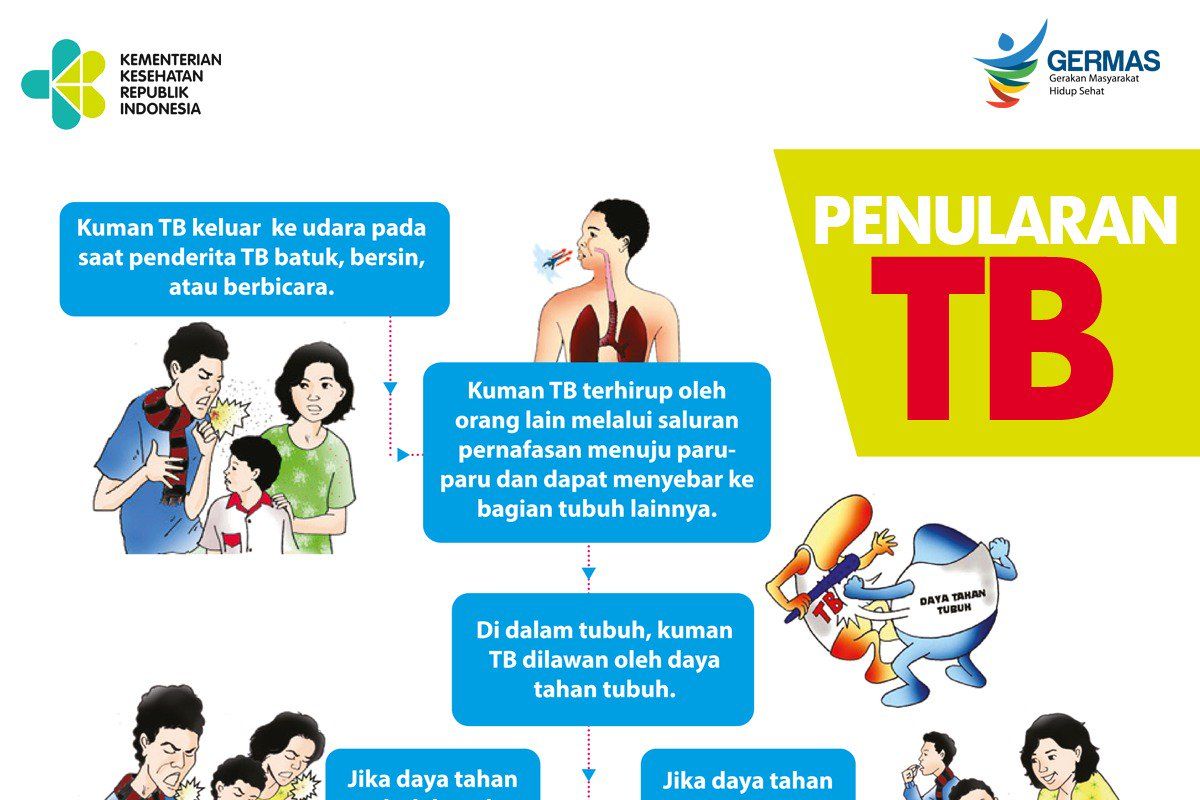 Dinkes OKU tekan penyebaran  Tuberkulosis