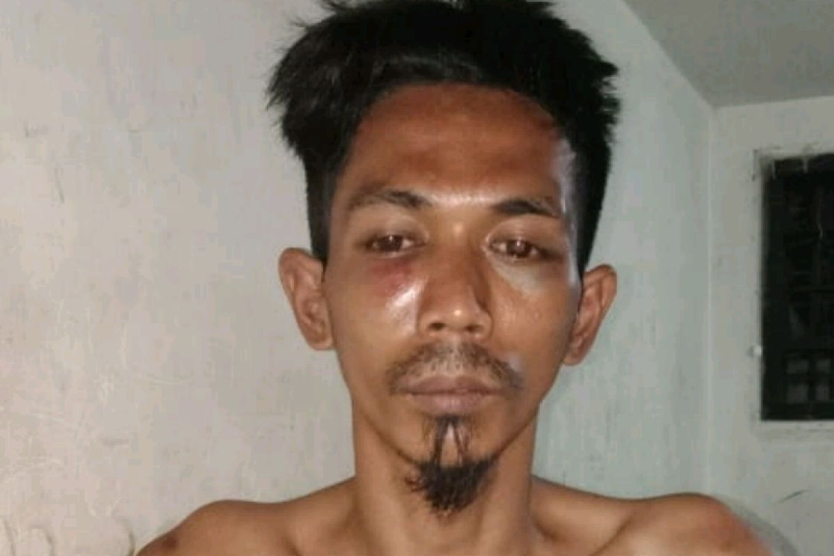 Polisi Medan Area ringkus pemuda pencuri sepeda motor