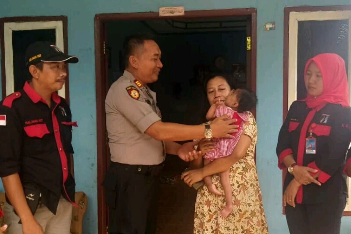 KRNS dan polisi bantu balita cacat fisik di Simalungun