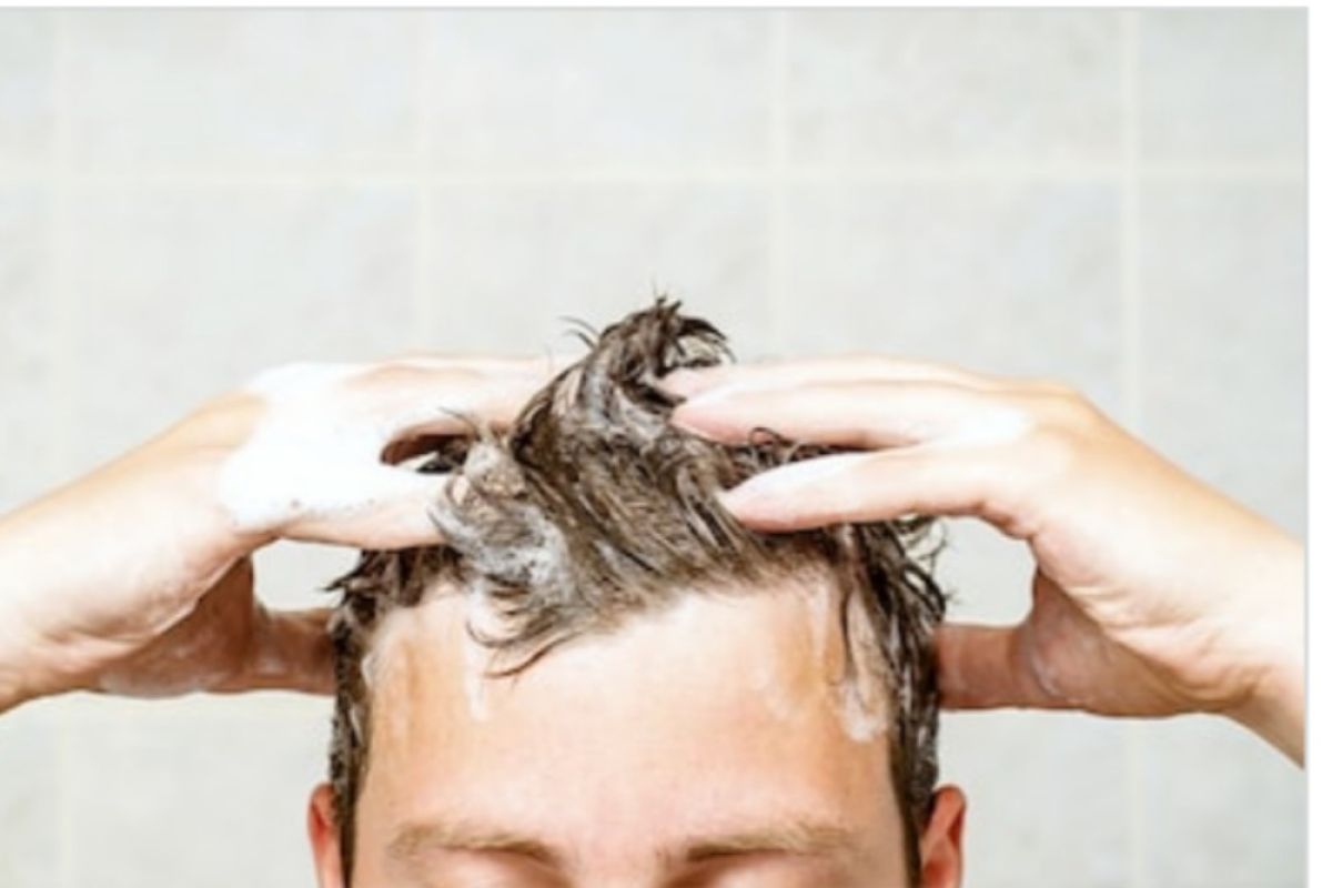 Tahukah sebab kulit kepala bisa berbau tak sedap?