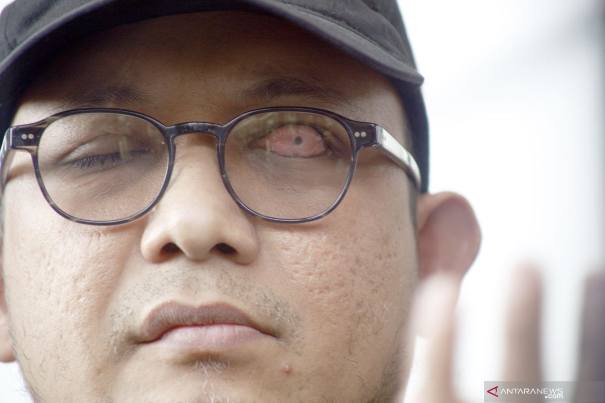 Penyidik KPK Novel Baswedan positif terjangkit COVID-19