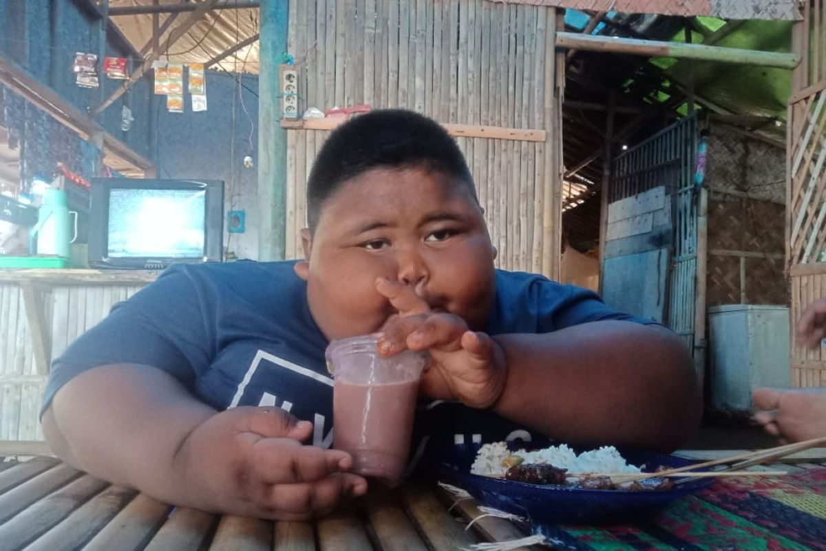 Satia Putra bocah obesitas di Karawang akan diobservasi di RSUD