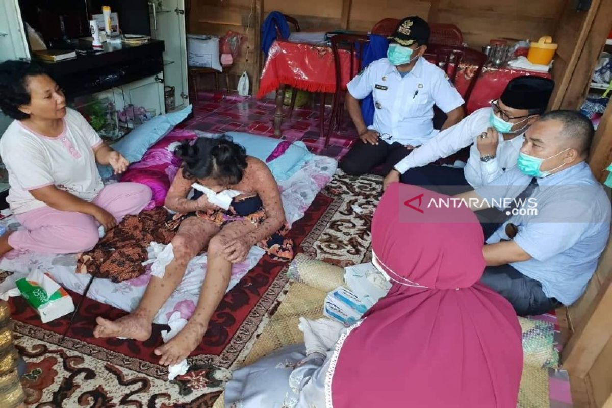 Menderita penyakit langka, Gadis dirujuk ke RSUD Panyabungan