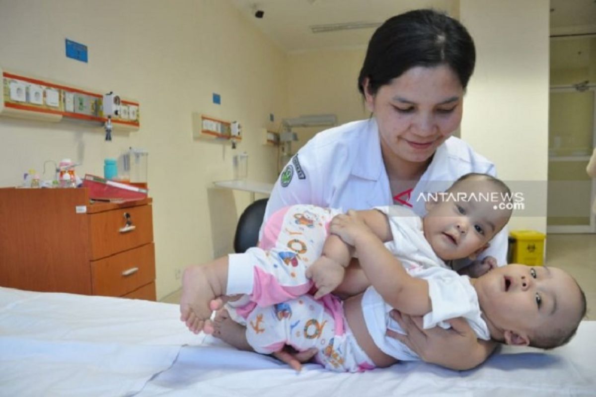 Bayi kembar siam dempet Adam dan Malik mulai jalani operasi pemisahan di Medan