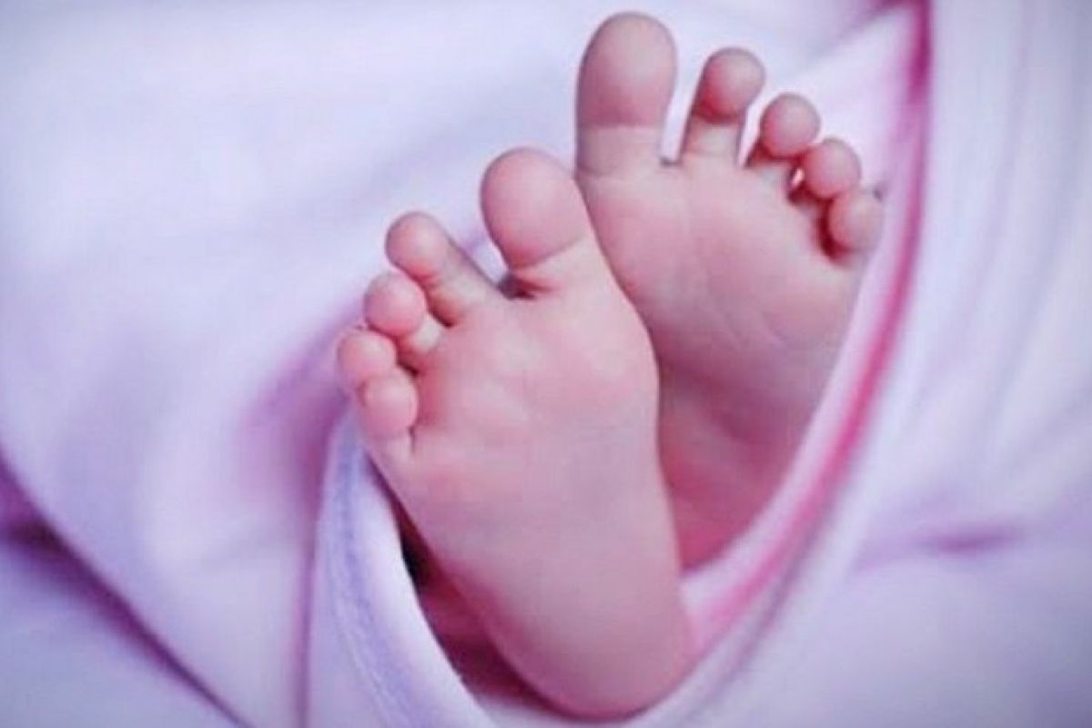 Bayi yang lahir dengan usus di luar perut akhirnya meninggal dunia