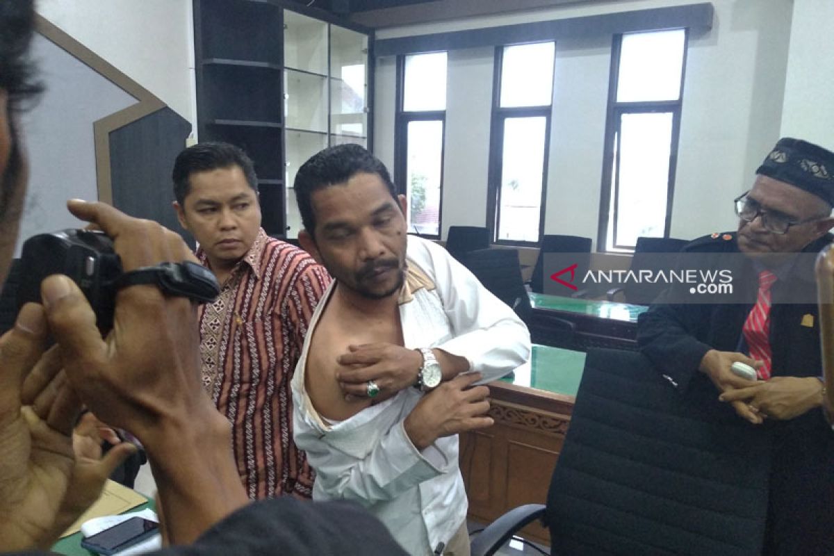 Anggota DPR Aceh mengaku lebam karena dipukuli polisi