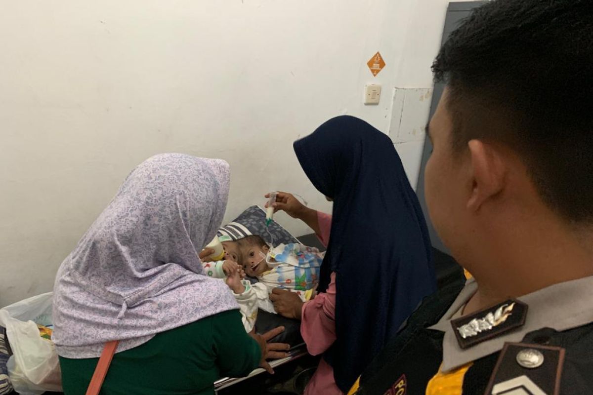 Bayi kembar siam mendapat perawatan intensif di RSUD Cianjur