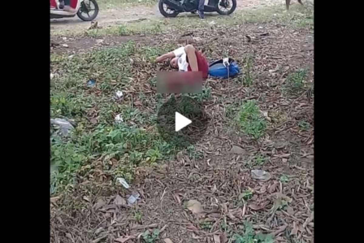 Video viral di medsos, seorang pelajar SD bernasib malang kehilangan kaki kanan tertabrak pick up