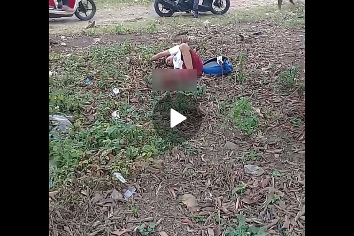 Video viral di medsos, seorang pelajar SD putus kaki tertabrak pick up