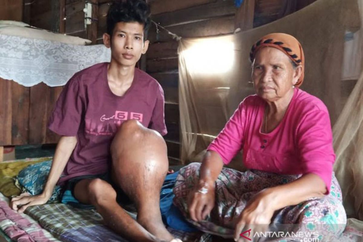 Penderita kanker tulang di Palangka Raya butuh bantuan untuk berobat