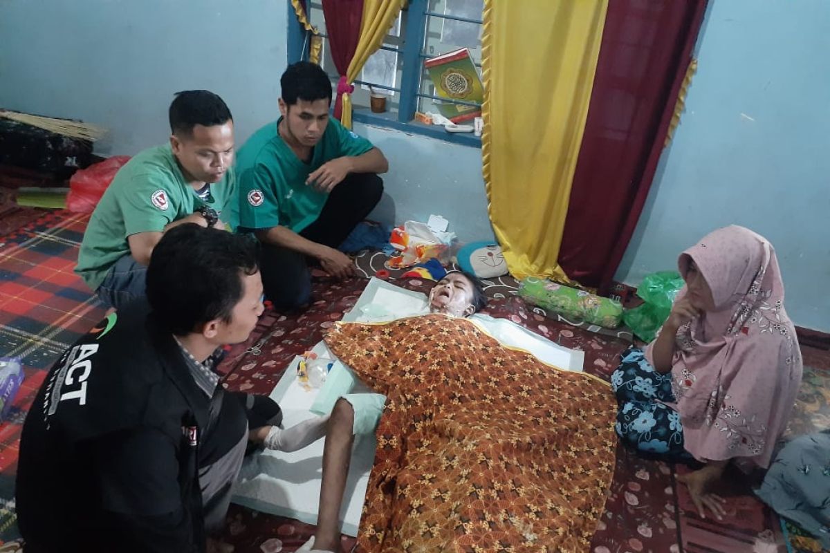 ACT NTB obati bocah korban kebakaran