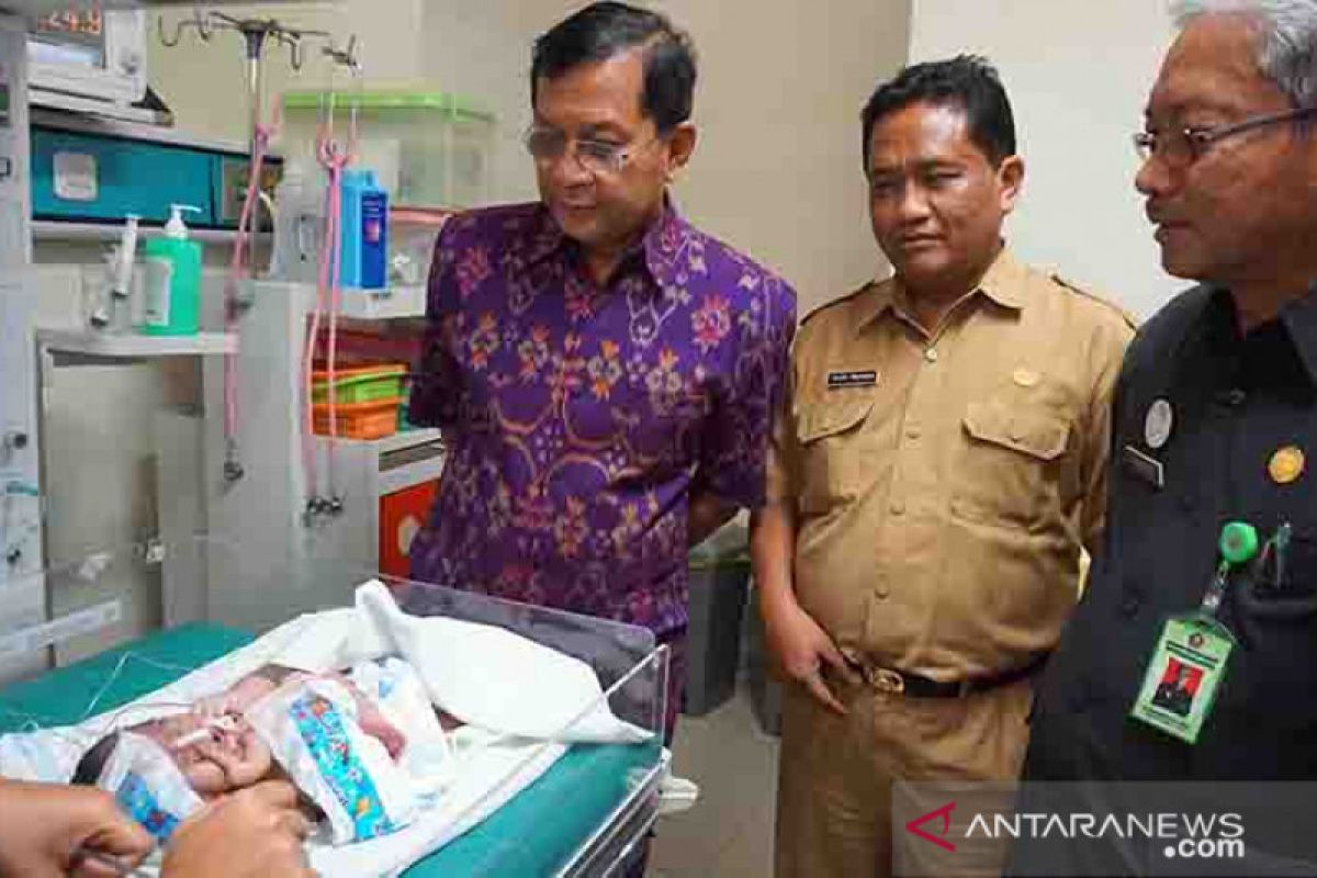 Bayi dengan banyak kelainan lahir di Buleleng