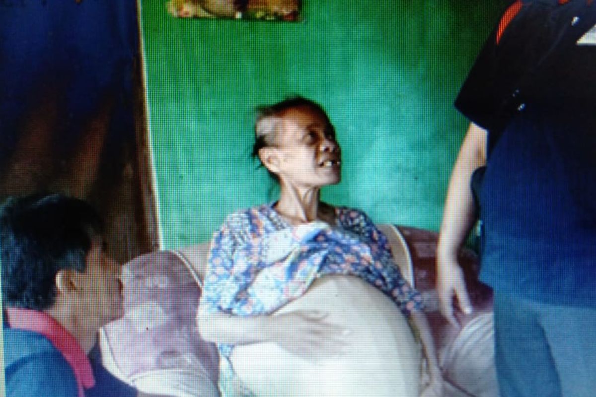 Janda miskin menderita tumor perut, F-Gerindra DPRD Pandeglang bantu pengobatan
