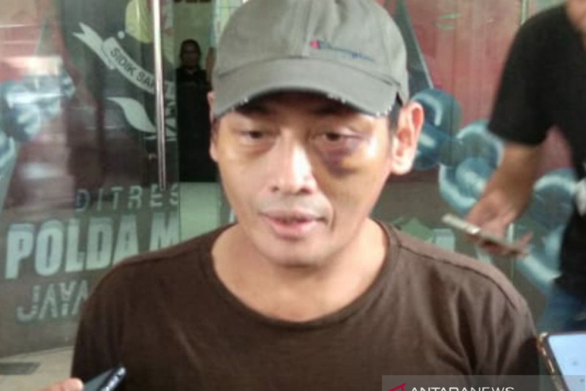Ninoy Karundeng,  pegiat medsos yang diculik dan dianiaya