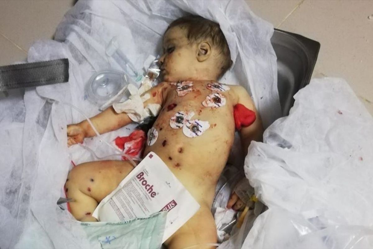 Bayi sembilan bulan korban serangan PKK/YPG