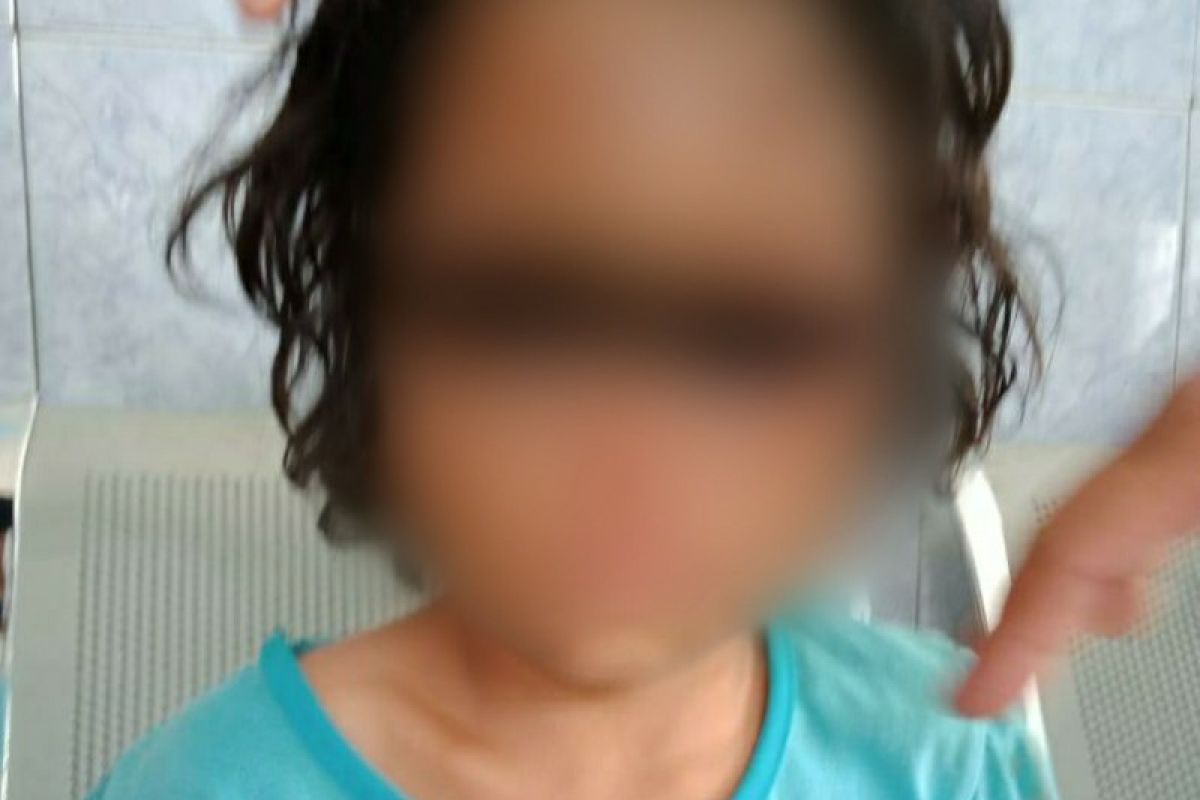 Anak perempuan 8 tahun jadi korban penganiayaan karena mencuri uang