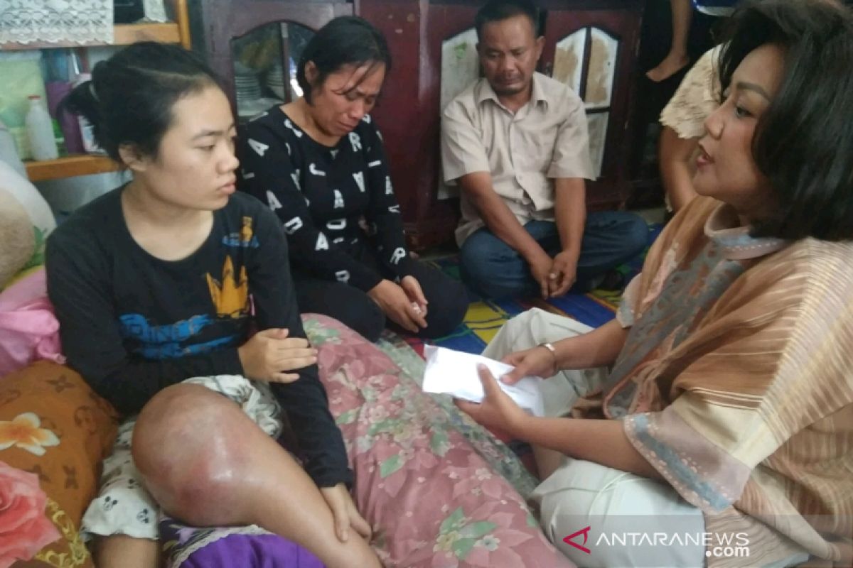 Kunjungi Ayu penderita tumor tulang, Satika: Tuhan mengasihimu