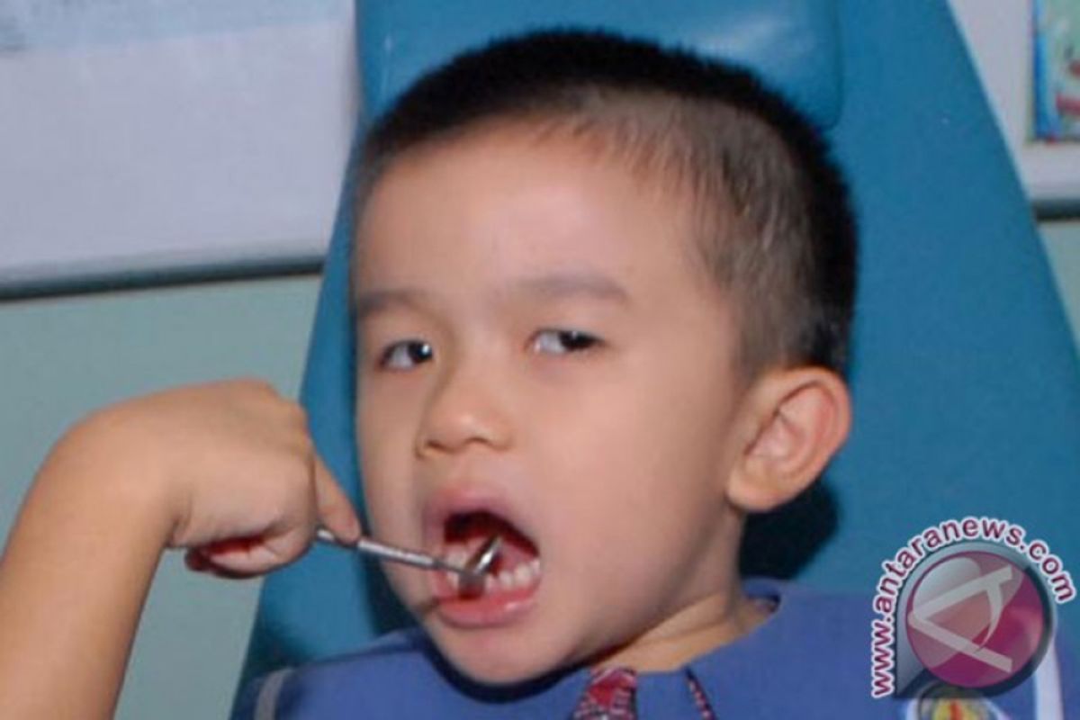 Dinkes Surabaya galakkan pencegahan penyakit karies gigi sejak dini