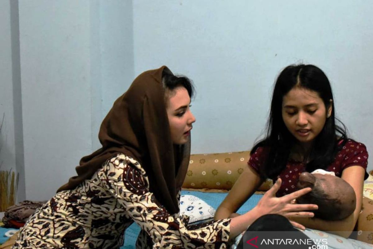 Pemprov Jatim siapkan tim dokter spesialis tangani bayi hydrocephalus asal Surabaya