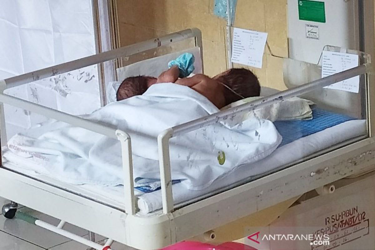 Bayi kembar dempet dada-perut di Kalteng akan dirujuk ke Surabaya