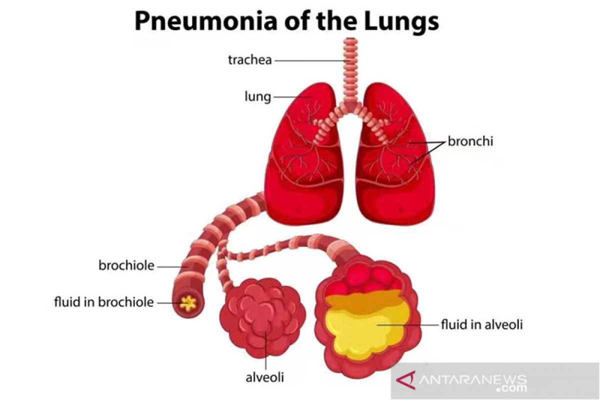 China konfirmasi 139 kasus baru pneumonia selama akhir pekan