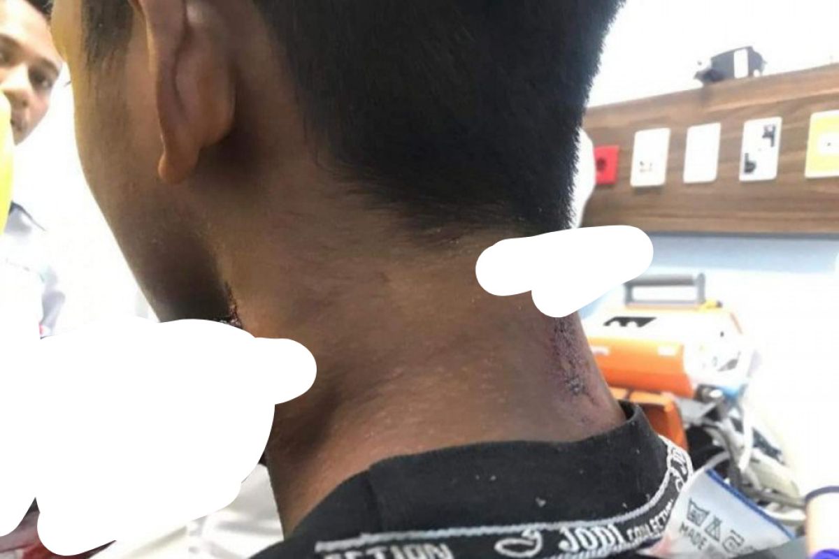 Heboh, seorang pelajar diserang ikan cenro sampai tembus leher