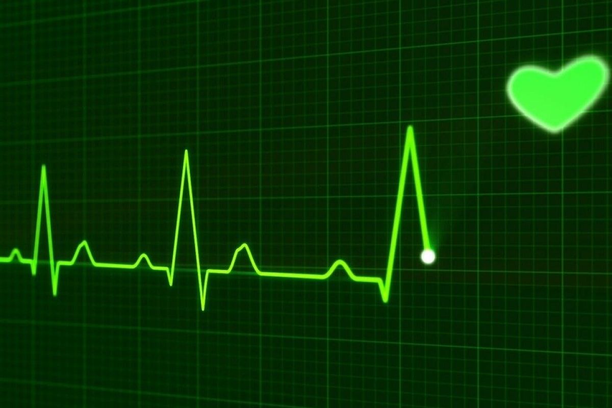 Atasi gangguan irama jantung bisa tanpa obat
