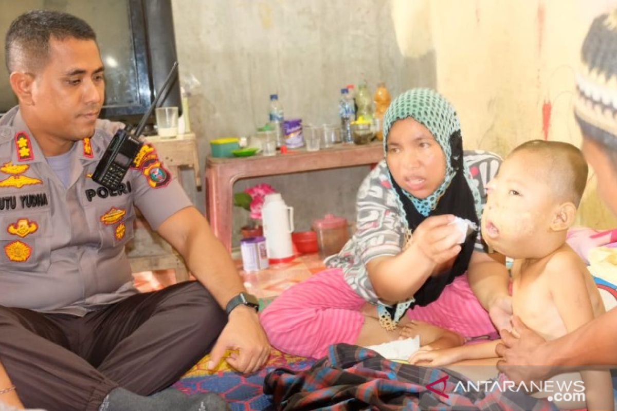 Kapolres Tanjungbalai salurkan bantuan kepada anak penderita tumor