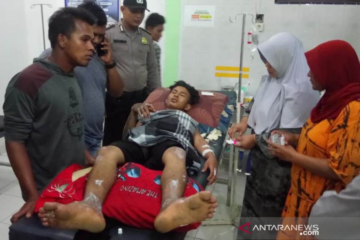 Kiosnya terbakar, seorang remaja di Aceh Jaya alami luka bakar