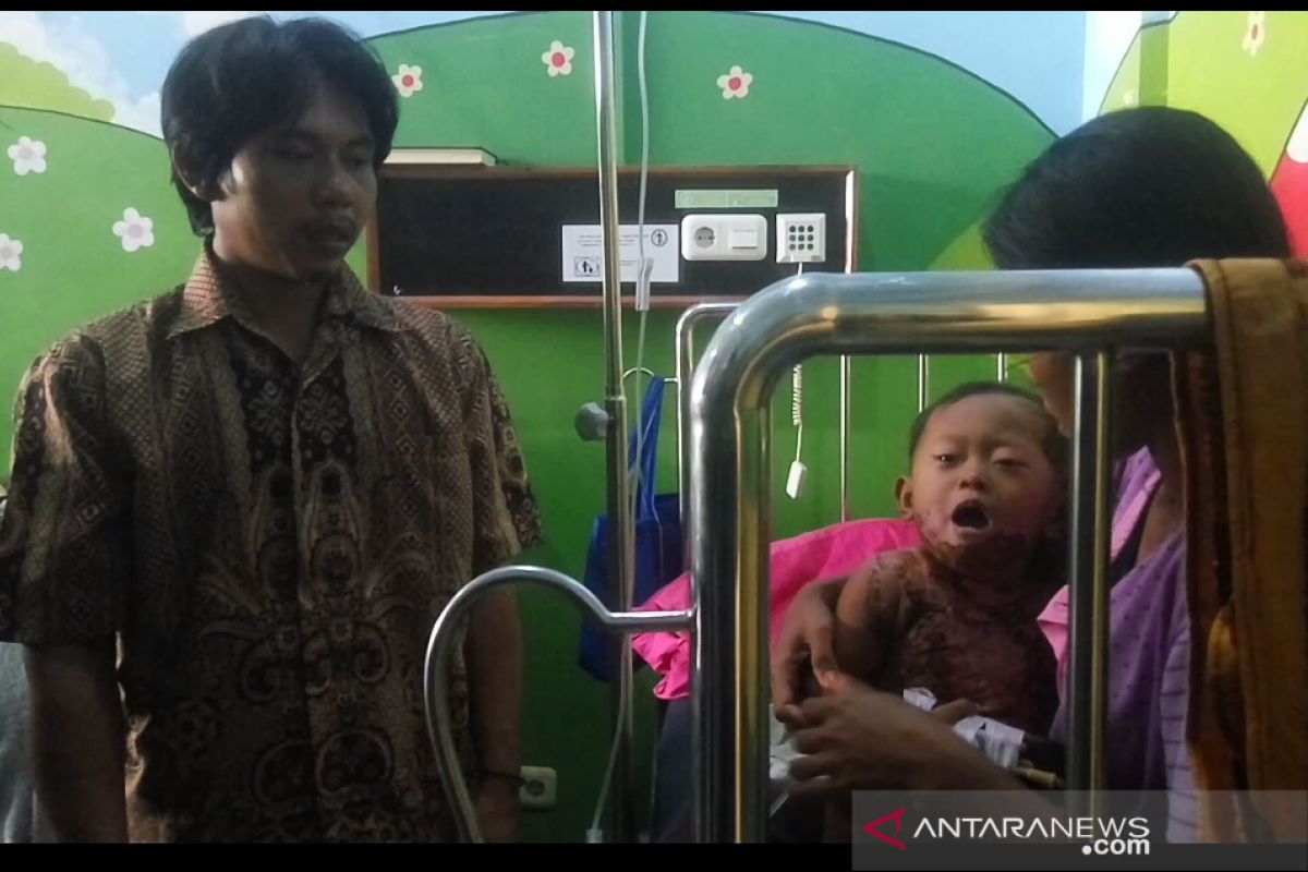 Widya, bocah tersiram air panas di Lampung Timur dapat bantuan AKRAP