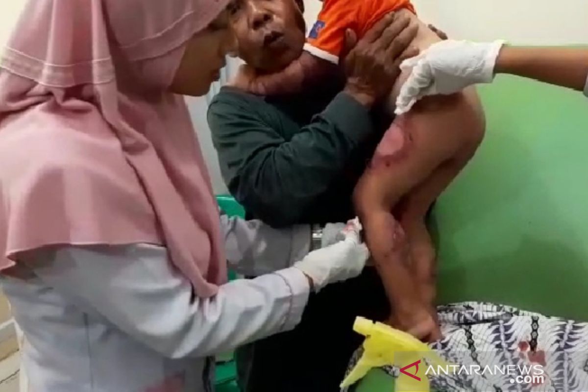 Anak-anak pengungsi korban banjir Sukajaya Bogor terserang penyakit kulit