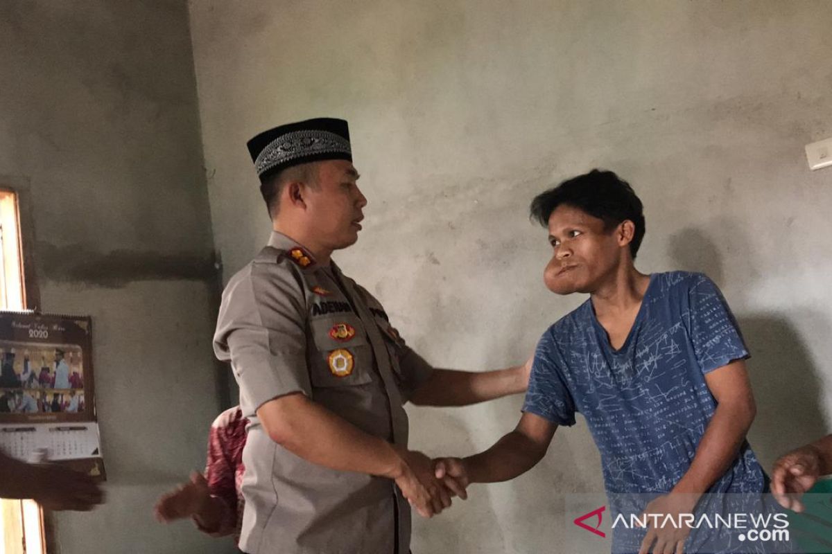 Polisi Bangka Barat santuni penderita tumor