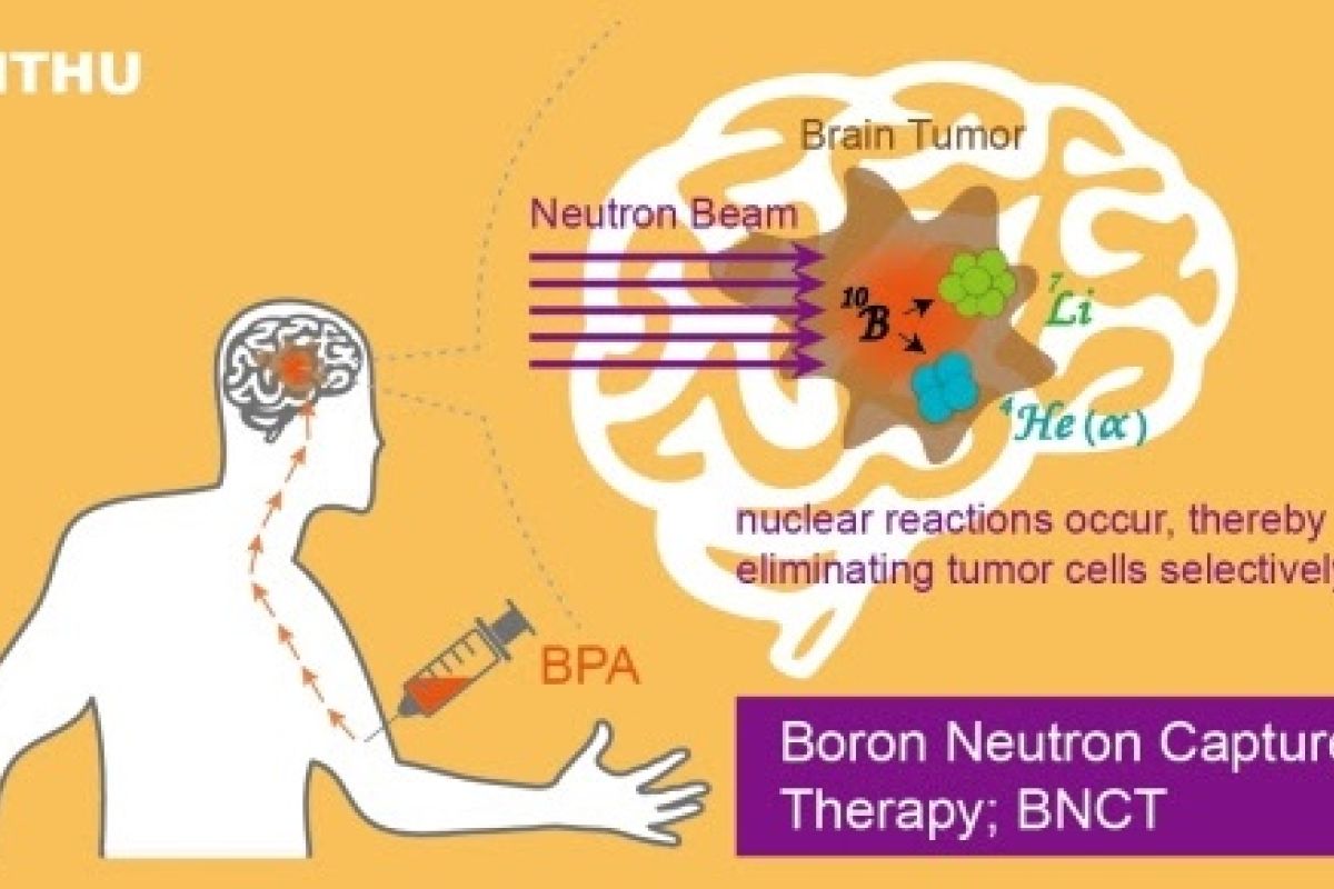 NTHU’s Boron Neutron Capture Therapy Center begins treating overseas brain cancer patients