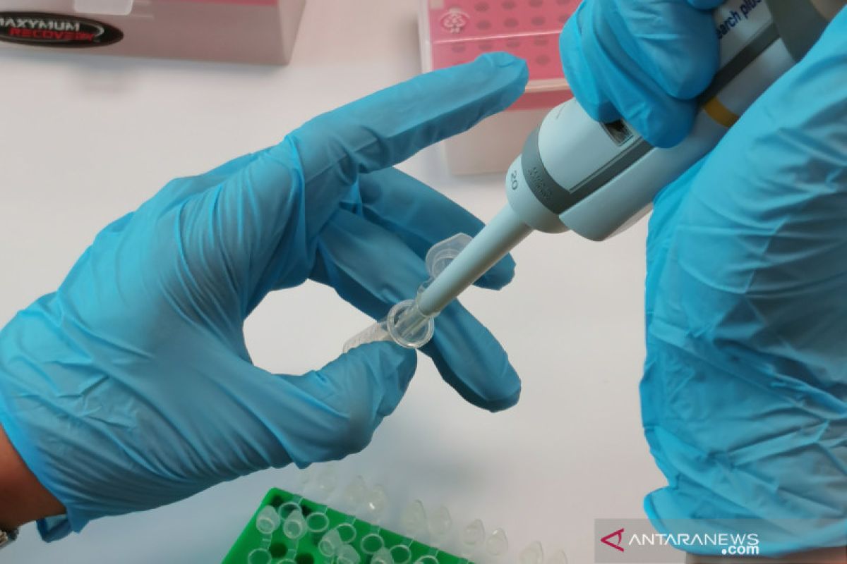 Prototype of qPCR COVID-19 test kit made in Indonesia completed