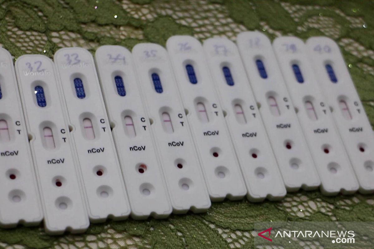 Bengkulu dapat bantuan 4.800 alat rapid test COVID-19