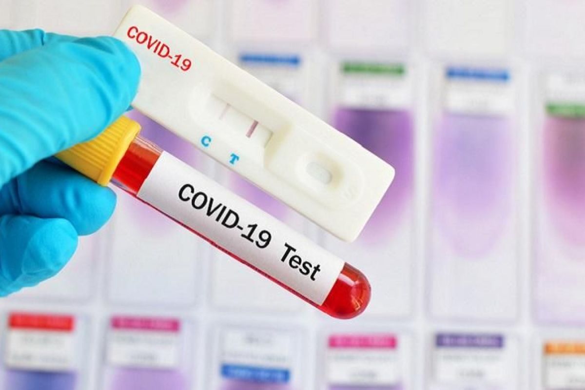 Diskes Bengkalis baru gunakan 220 rapid test COVID-19