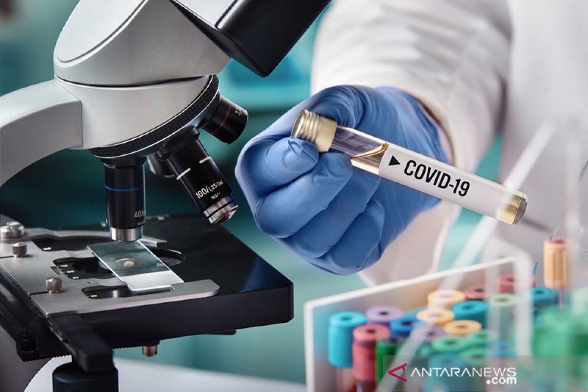 Menristek: 50.000 alat tes COVID-19 non PCR akan diproduksi Juni 2020