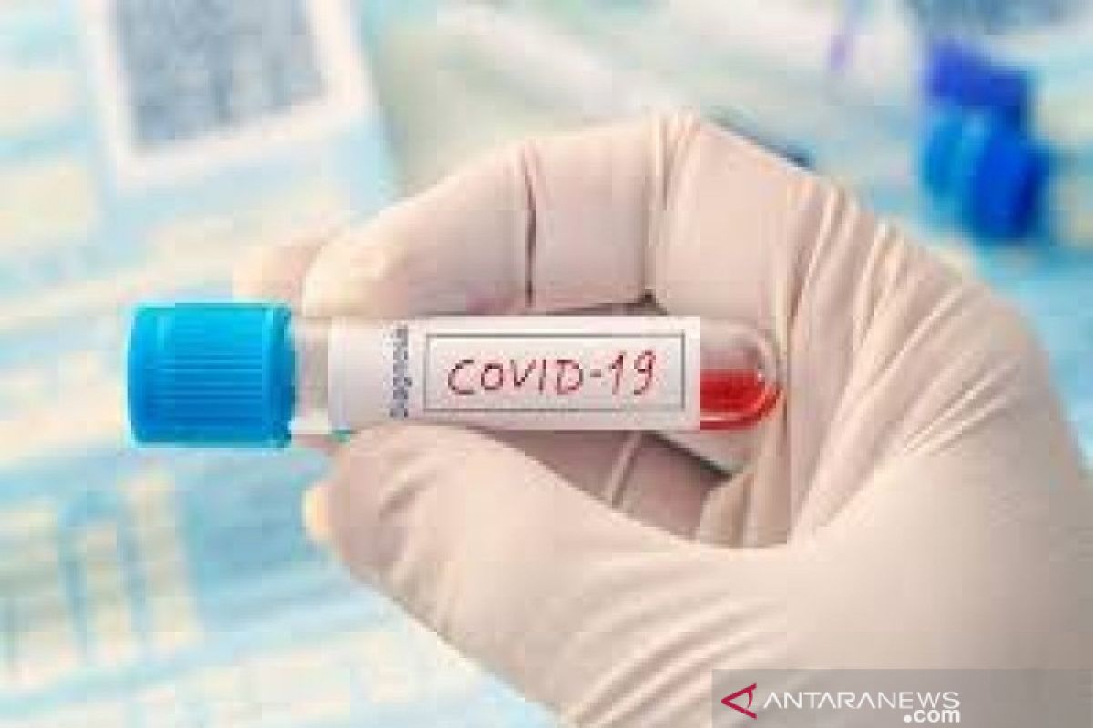 Peserta ijtima Gowa asal Barsel terindikasi terpapar COVID-19 dari hasil rapid test