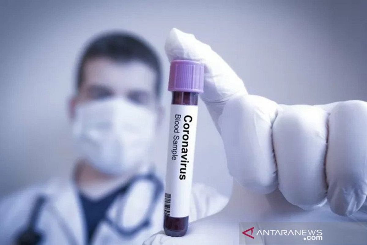 Laboratorium di Amerika Serikat mulai uji antibodi virus corona