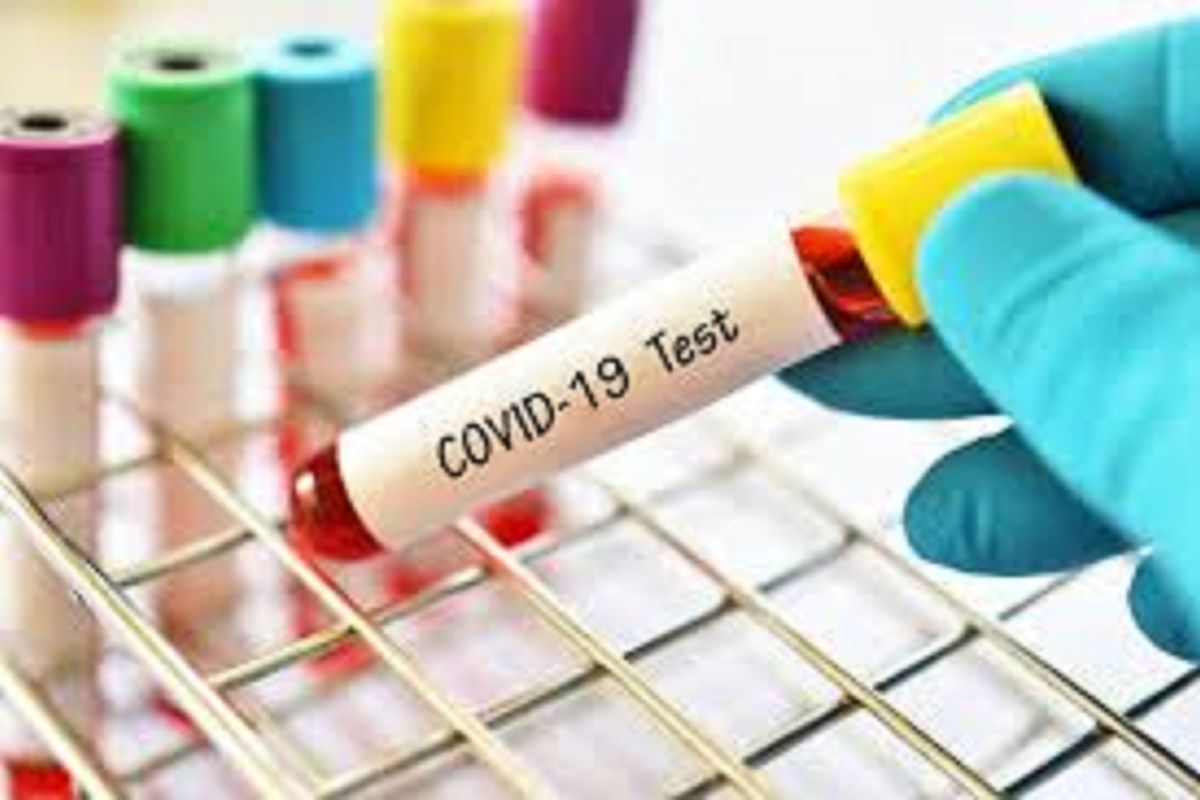 Menristek ungkap 50.000 alat tes COVID-19 non PCR akan diproduksi Juni 2020