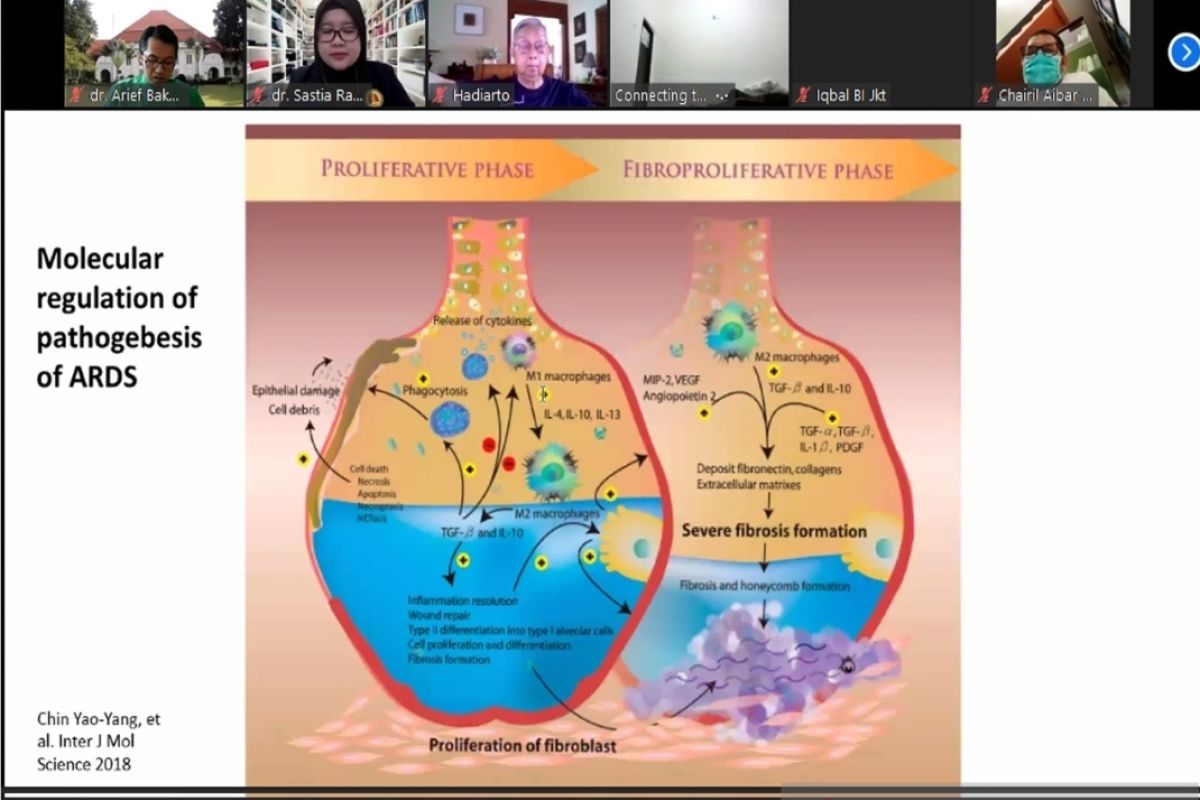 Dokter paru sebut pasien sembuh dari COVID-19 berisiko alami fibrosis