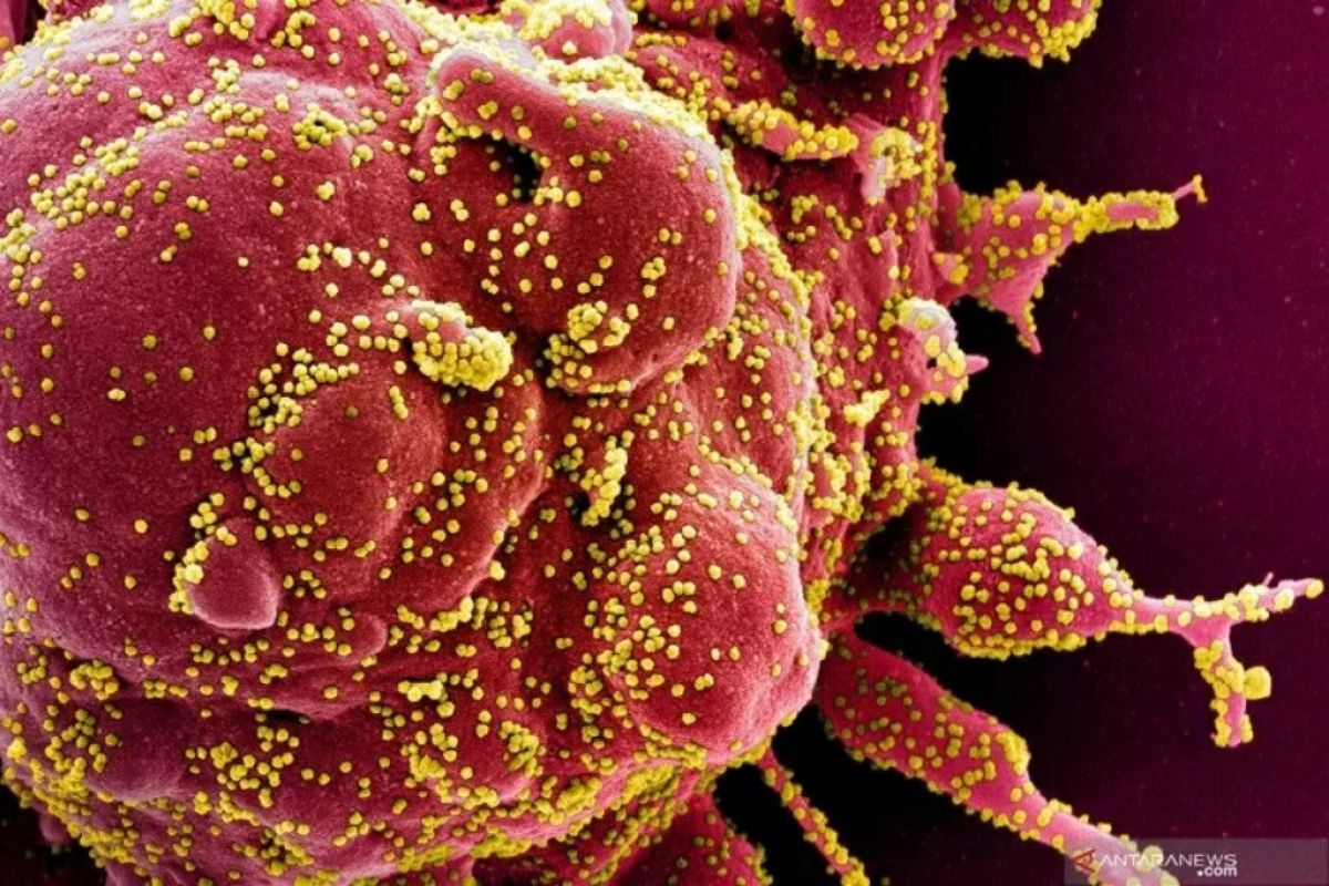 WHO:  4.013.728 kasus virus corona di dunia