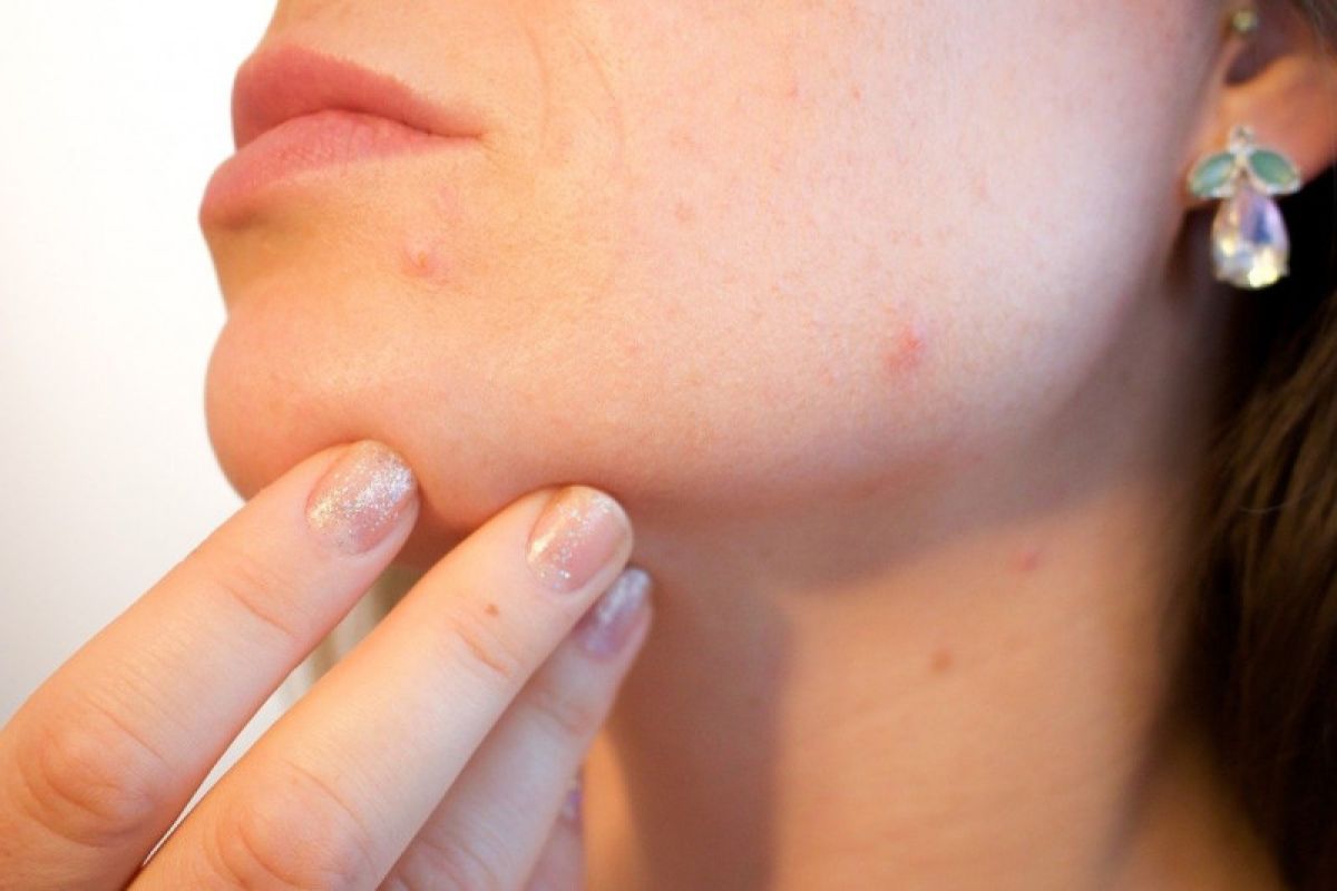 Cara perbaiki tekstur kulit kasar menurut ahli