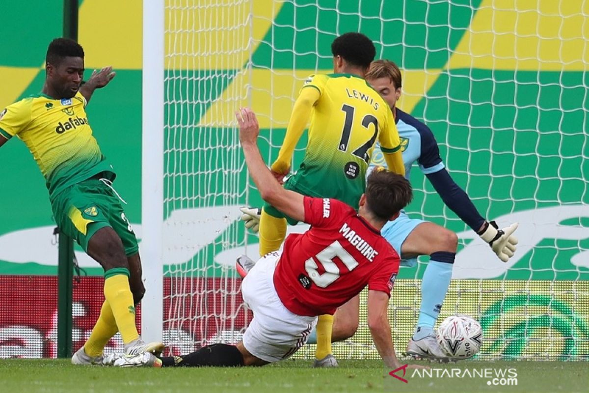 Piala FA - MU butuh babak tambahan untuk lewati 10 pemain Norwich