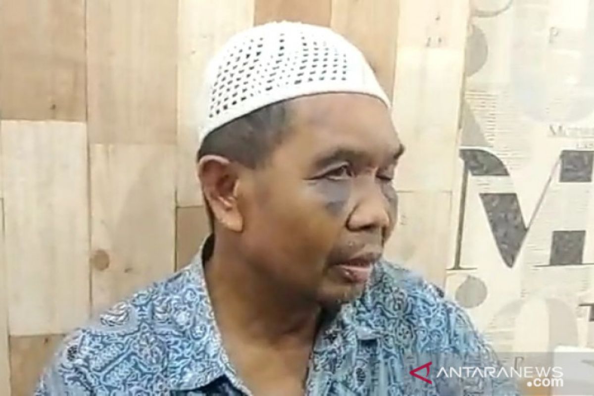 Polrestabes Medan periksa Sarpan, saksi pembunuhan yang dianiaya oknum polisi
