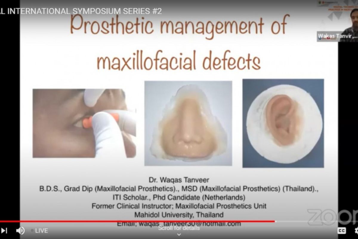 Ahli gigi beberkan pentingnya teknologi prostetik  maksilofasial