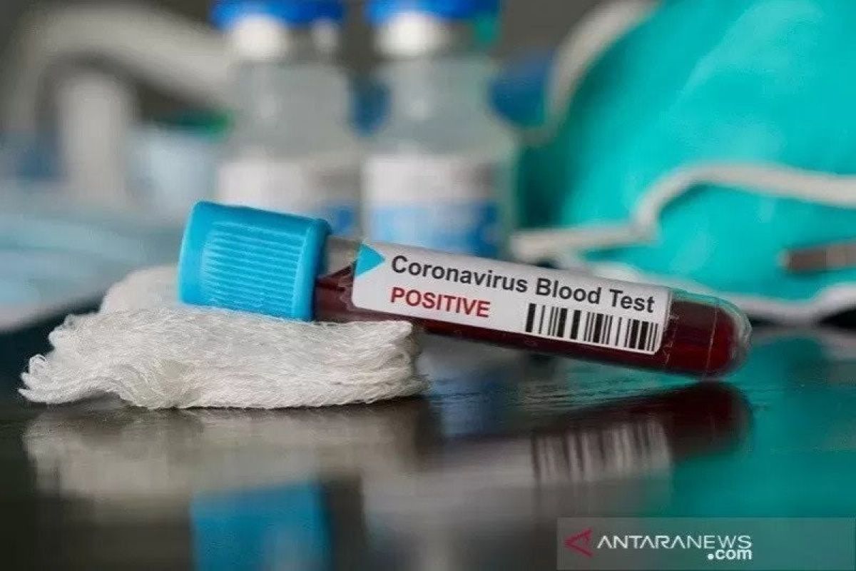 Dua pasien di Eropa kembali terinfeksi virus corona