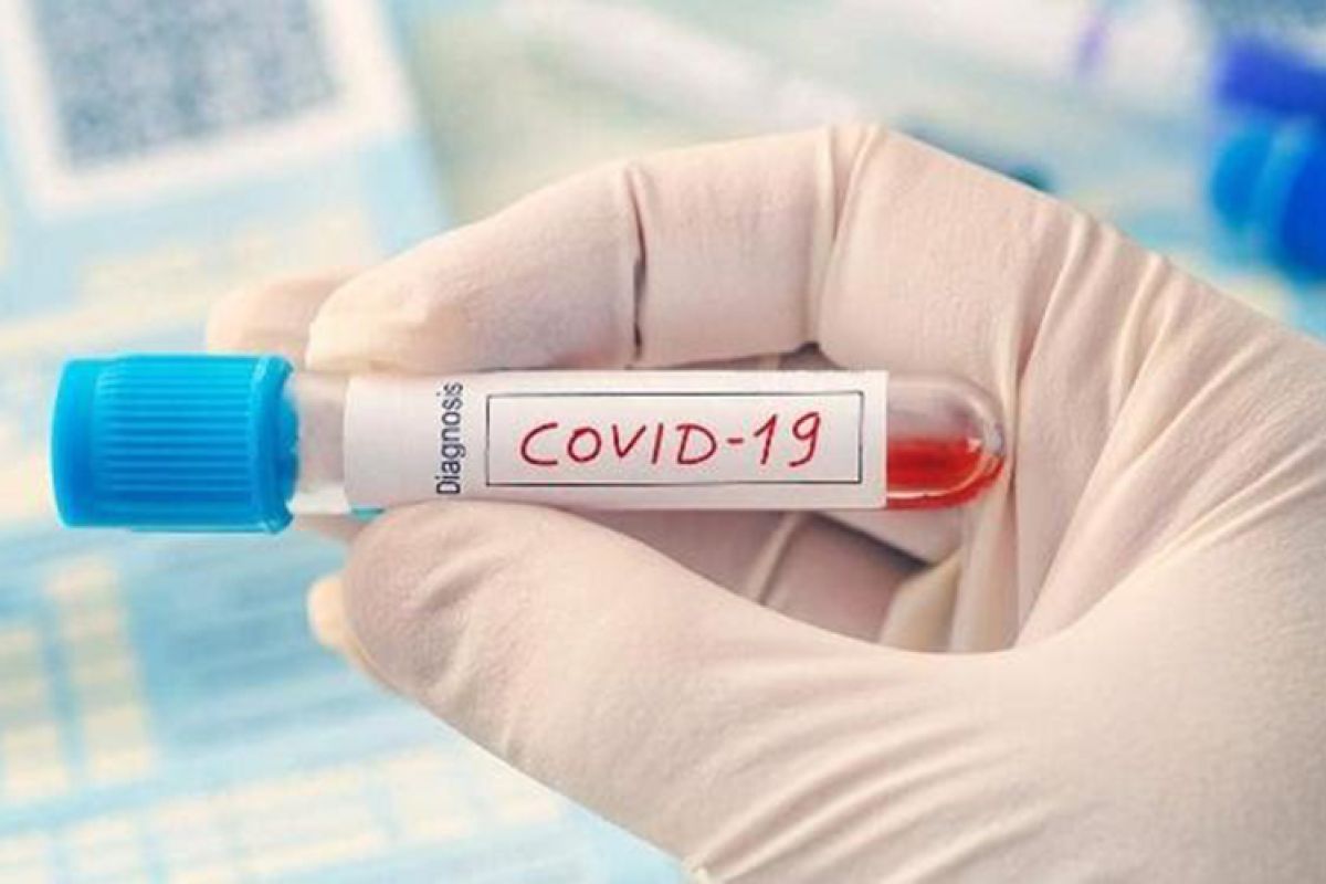 Seorang bayi laki-laki baru lahir terkonfirmasi positif COVID-19